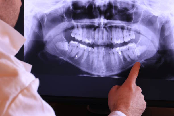 Best Emergency Tooth Extraction in Hayti, MO